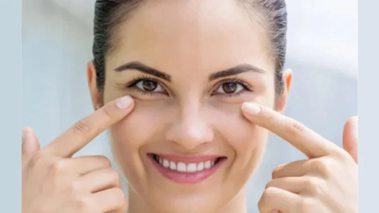 9 Home Remedies to Reduce Under-Eye Puffiness