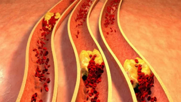 Natural Ways to Lower Cholesterol